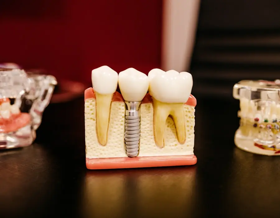 Sonrisa real tras tratamiento dental