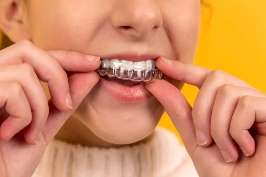 Limpieza dental en clínica